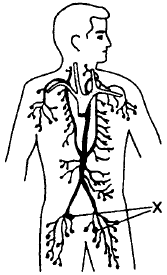Lymphsystem Bild Skizze Darstellung